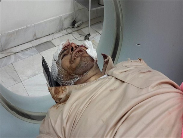 یک کشته براثر واژگونی خودروی حامل زائران عراقی در نهاوند+ عکس