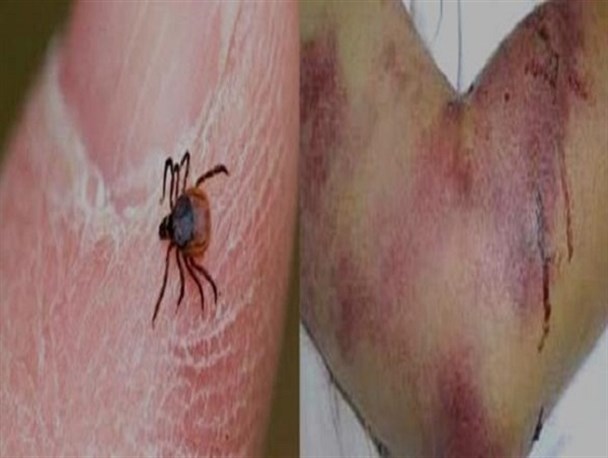 بیماری تب خونریزی‌دهنده کریمه کنگو در انتظار کشتارکنندگان غیرمجاز دام