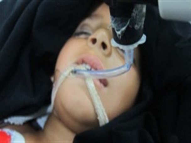 عقرب جان کودک4ساله را گرفت