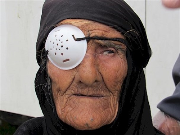 بازگشت نور امید به چشمان بانوی 103ساله لنده‌ای به همت وزیر سابق بهداشت +تصاویر
