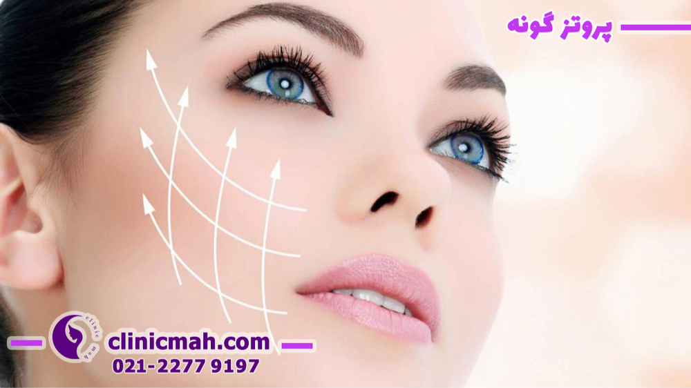 لیفتینگ با جراحی بهتر است یا تزریق؟ 