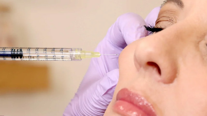 اشتباهات رایج بعد از مادلینگ صورت که باعث از بین رفتن فرم می‌شود، چیست؟