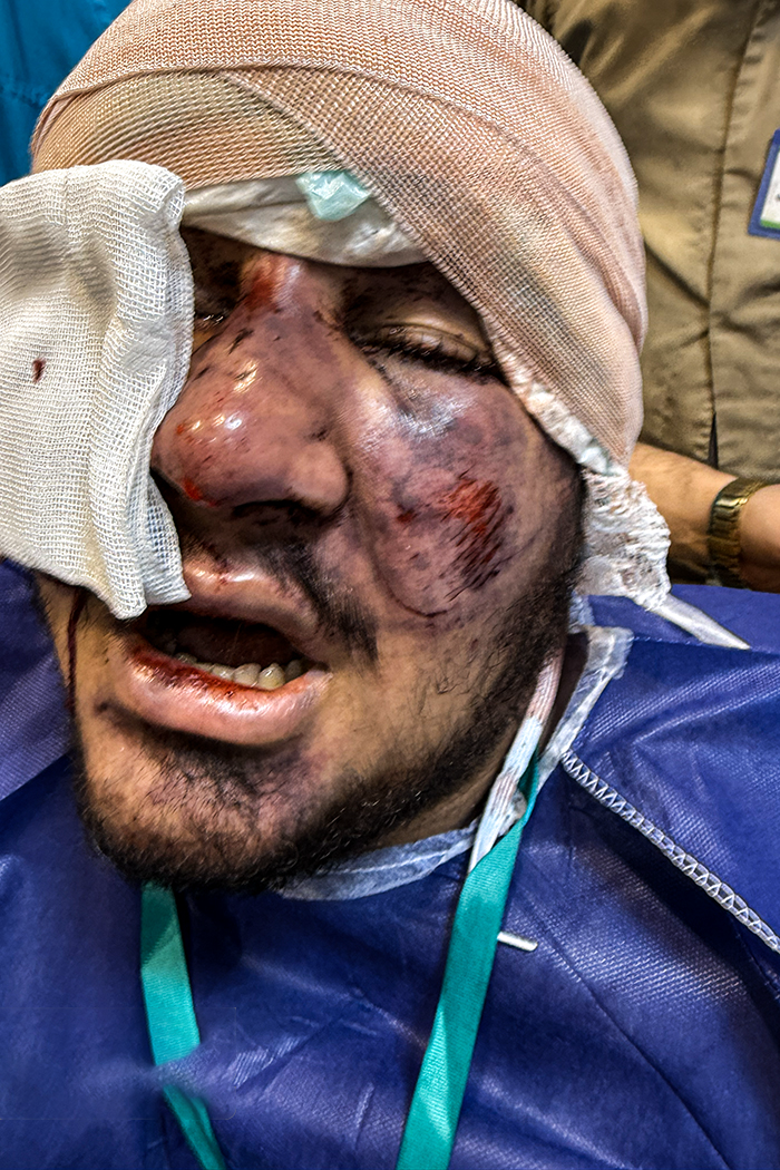 تصاویری وحشتناک از مجروحان حملات داعشی وار اغتشاشگران