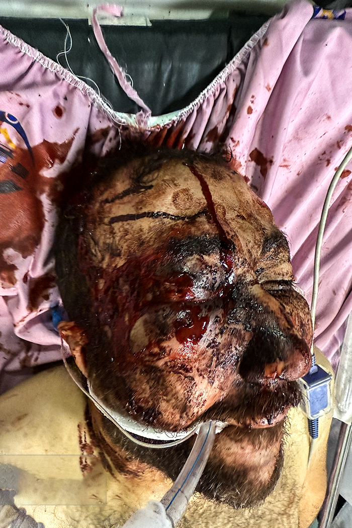 تصاویری وحشتناک از مجروحان حملات داعشی وار اغتشاشگران