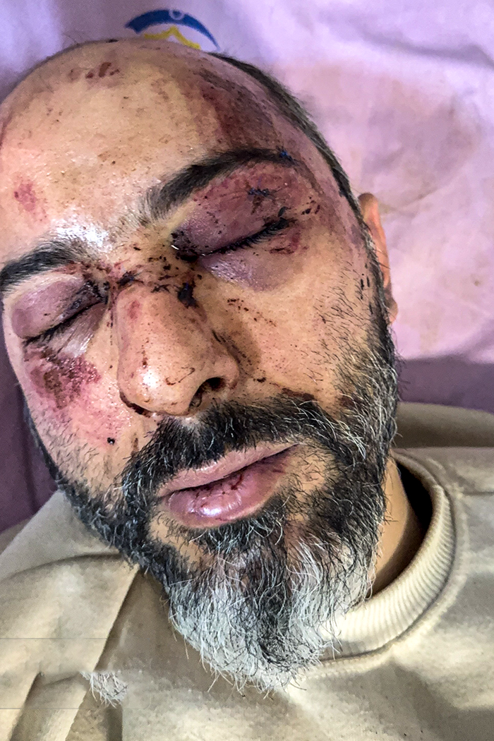 تصاویری وحشتناک از مجروحان حملات داعشی وار اغتشاشگران