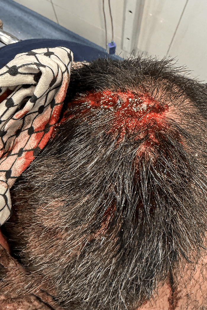 تصاویری وحشتناک از مجروحان حملات داعشی وار اغتشاشگران