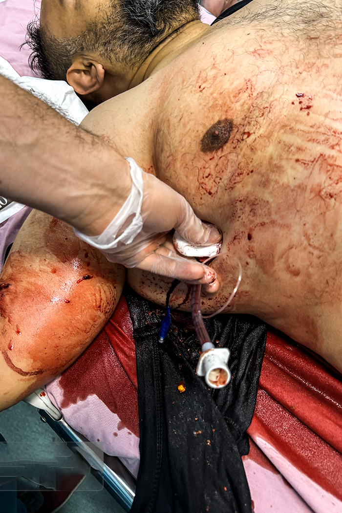 تصاویری وحشتناک از مجروحان حملات داعشی وار اغتشاشگران