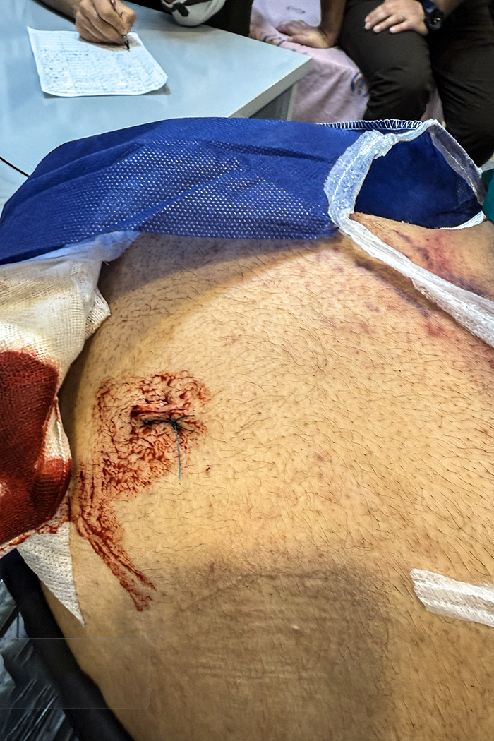 تصاویری وحشتناک از مجروحان حملات داعشی وار اغتشاشگران