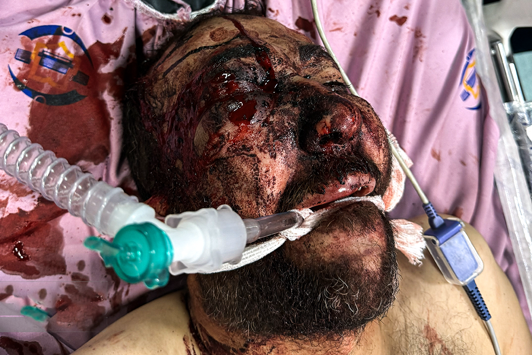 تصاویری وحشتناک از مجروحان حملات داعشی وار اغتشاشگران