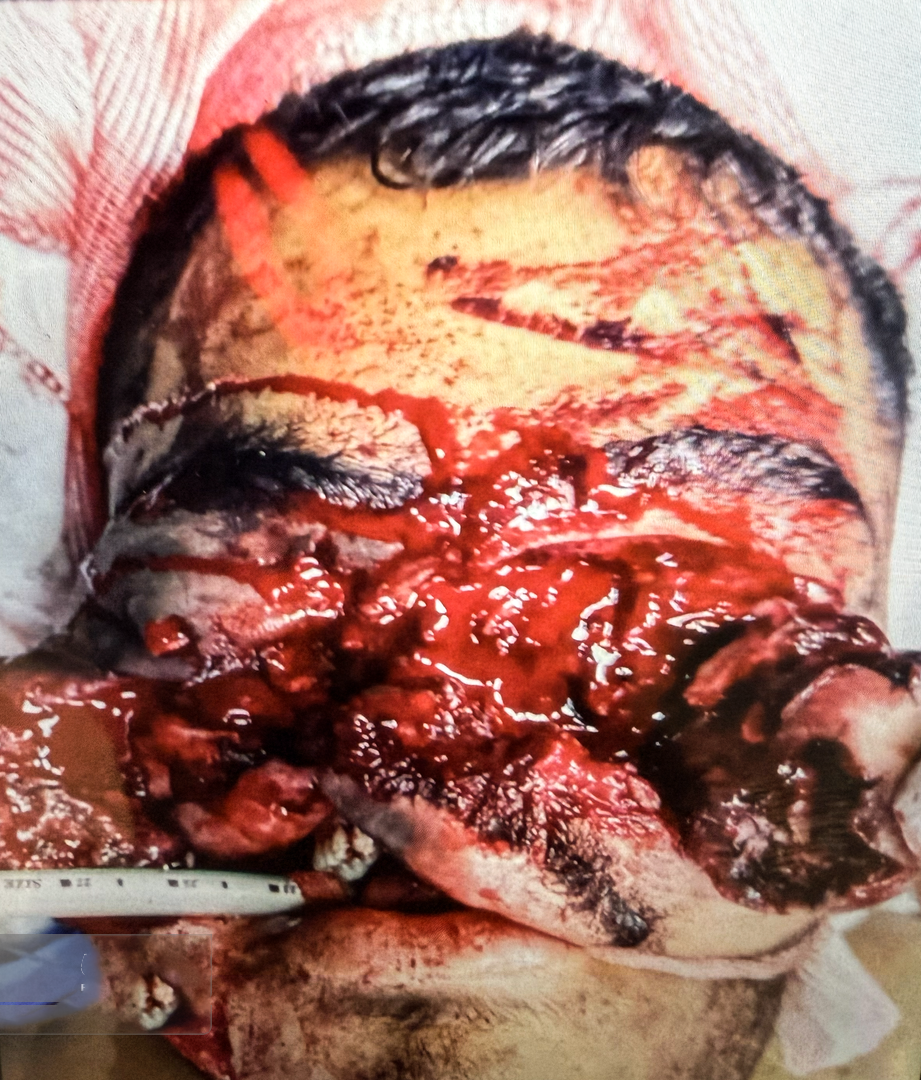 تصاویری وحشتناک از مجروحان حملات داعشی وار اغتشاشگران