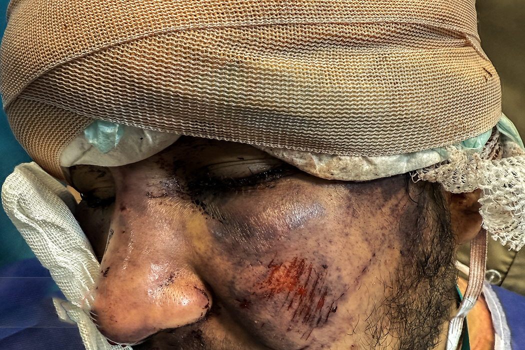 تصاویری وحشتناک از مجروحان حملات داعشی وار اغتشاشگران