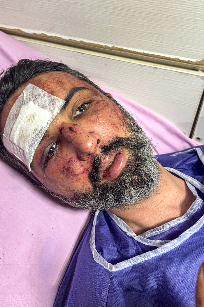 تصاویری وحشتناک از مجروحان حملات داعشی وار اغتشاشگران