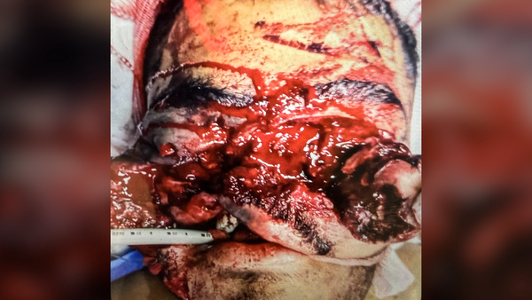تصاویری وحشتناک از مجروحان حملات داعشی وار اغتشاشگران