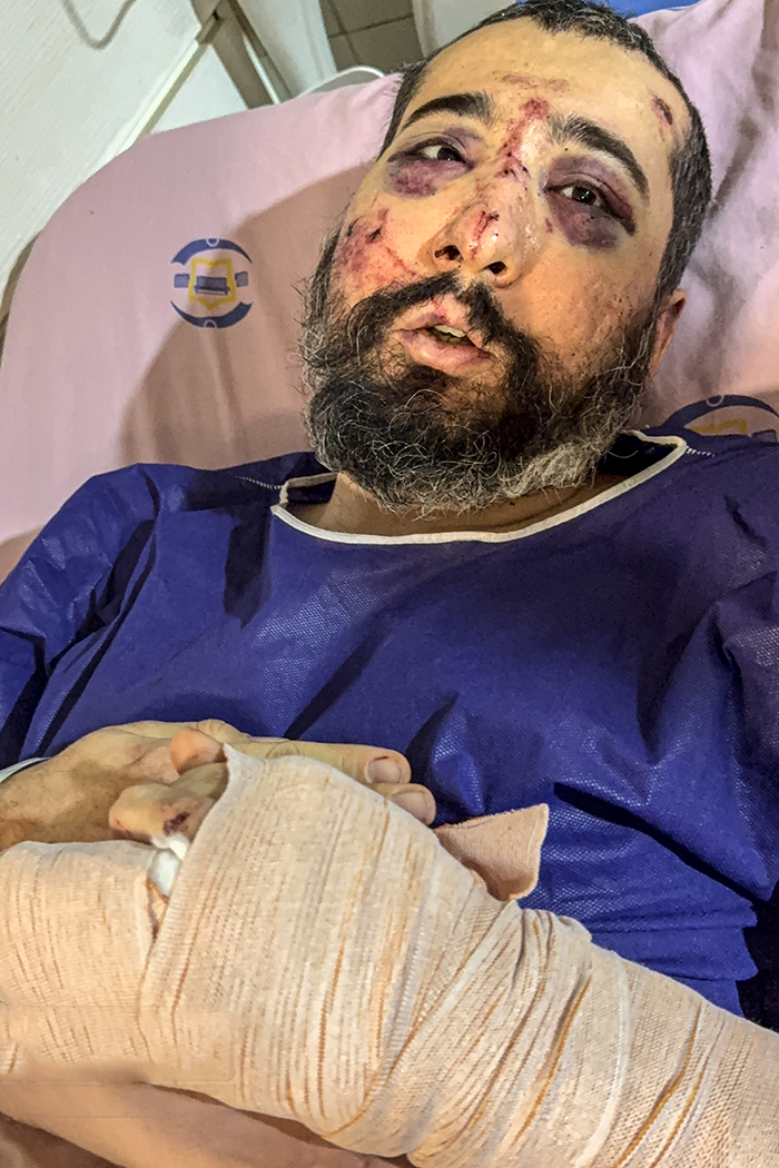 تصاویری وحشتناک از مجروحان حملات داعشی وار اغتشاشگران