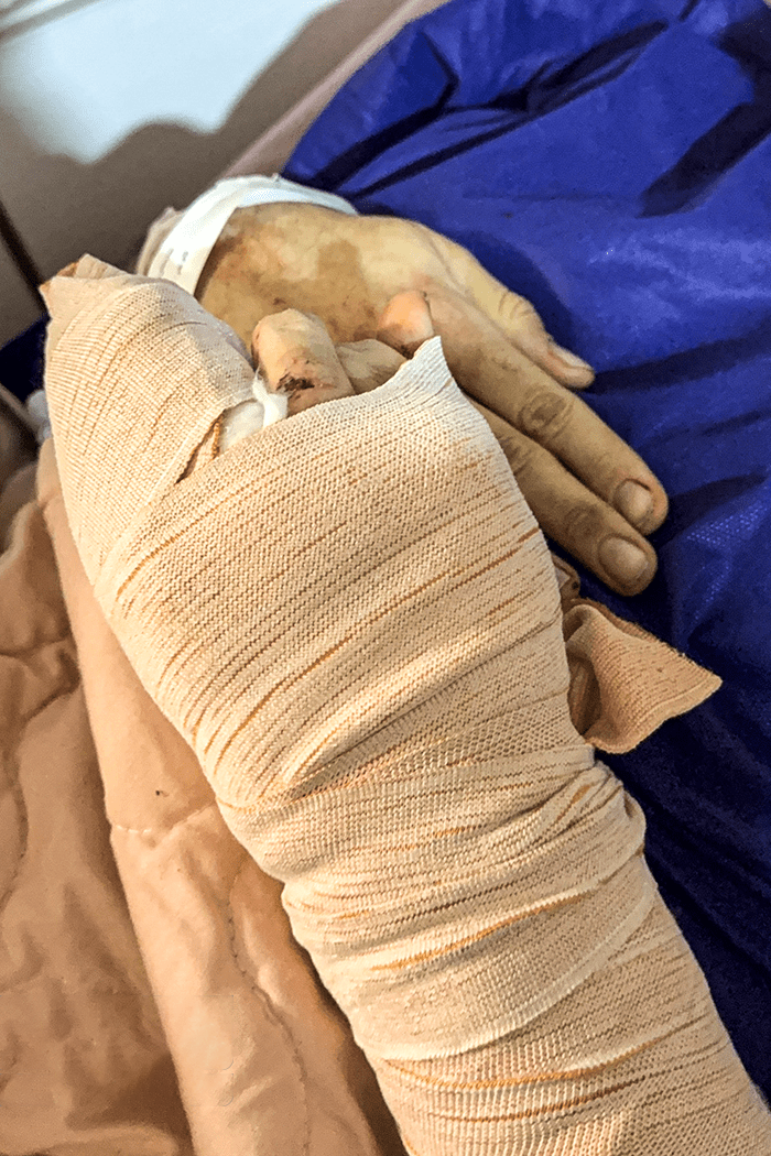 تصاویری وحشتناک از مجروحان حملات داعشی وار اغتشاشگران