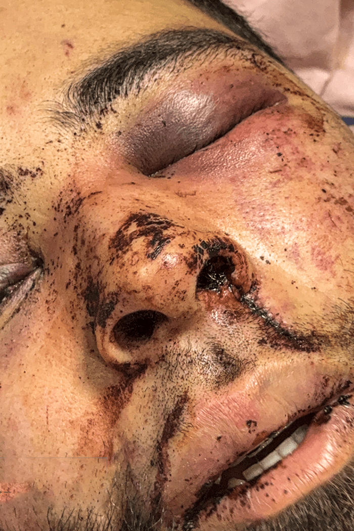 تصاویری وحشتناک از مجروحان حملات داعشی وار اغتشاشگران