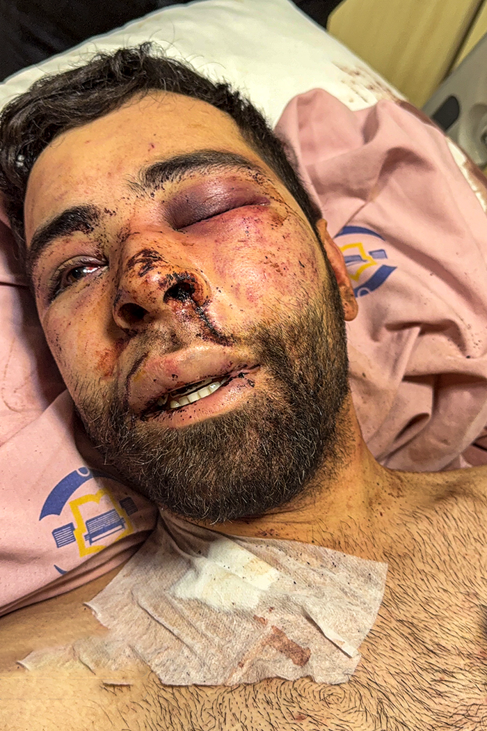 تصاویری وحشتناک از مجروحان حملات داعشی وار اغتشاشگران