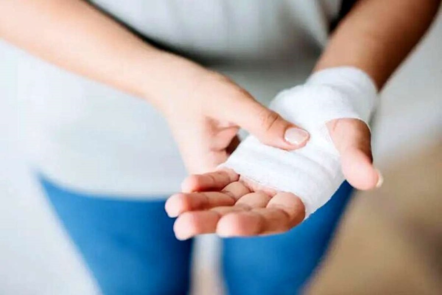  آموزش پانسمان زخم با وسایل در دسترس و بدون تجهیزات پزشکی