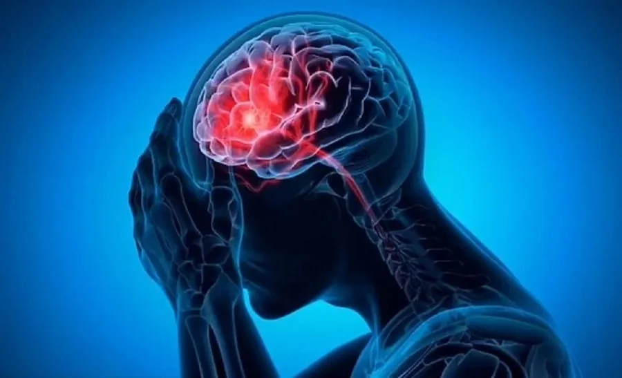 علائم سکته مغزی را بشناسید