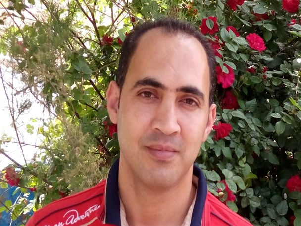 سوختگی های وحشتناک ، نتیجه بی مبالاتی افراد در چهارشنبه سوری است