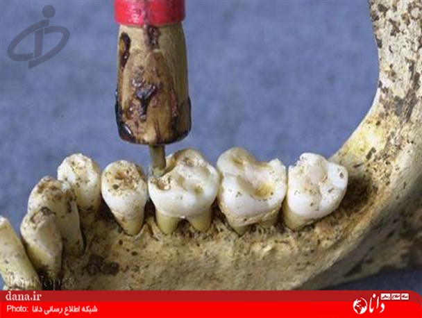 گزارش تصویری/ابزار های دندان پزشکی در گذشته ای نه چندان دور!!!