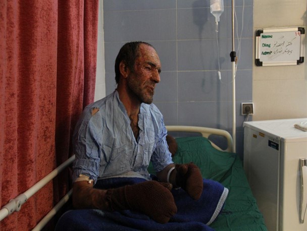 گزارشی از بخش سوختگی بیمارستان بعثت همدان: وقتی بدنت میسوزد گویا هر روز میسوزی+فیلم