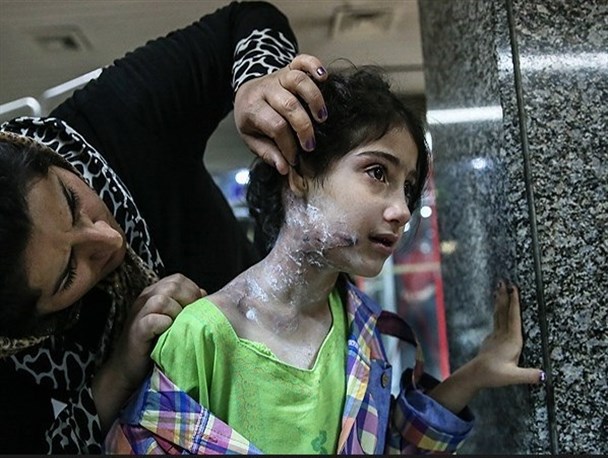 آسیب‌های روحی ماندگارتر از صدمات جسمی آتش بازی است/ انجام رفتارهای پر خطر با هدف پر کردن خلاء عاطفی