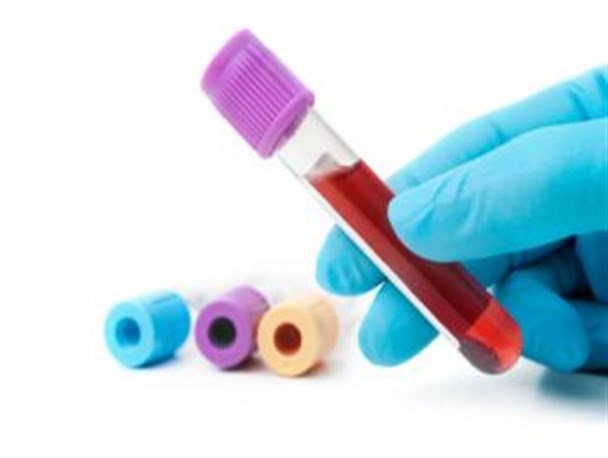 تجلیل از آزمایشگاهیان استان کرمانشاه به مناسبت روز علوم آزمایشگاهی