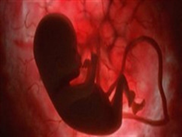 تبلیغات مجازی به سقط جنین رسید/ آموزش کشتار در فضای مجازی برای کسب درآمد