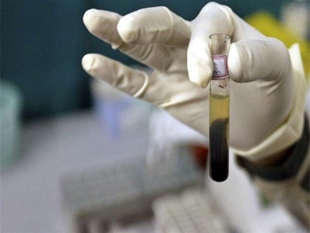 آخرین آمار "ایدز" در کشور/ زنان رکورداران HIV