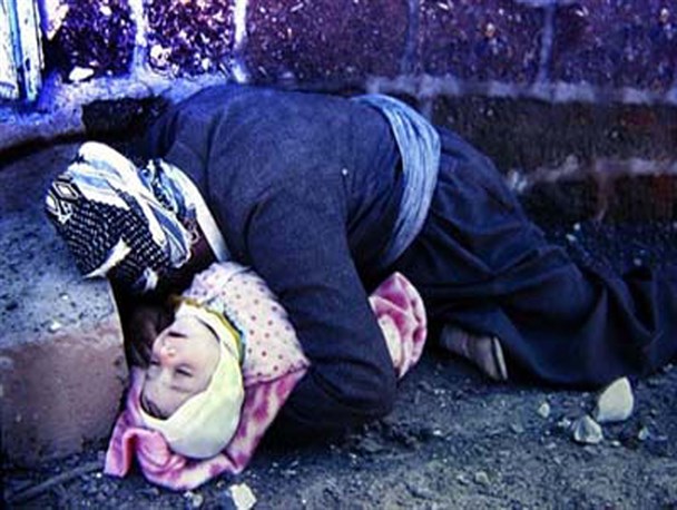 زخمی که بعد از 28سال التیام نیافته+عکس