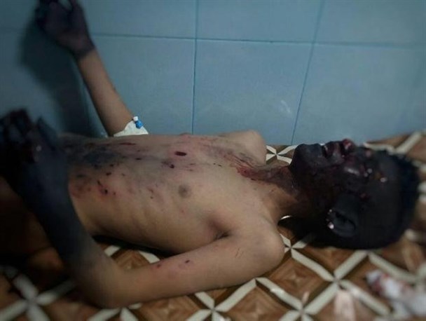 حوادث چهارشنبه سوری در بیجار موجب مصدومیت 12 نفر شد