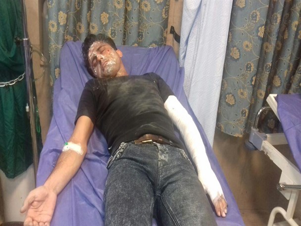 12 نفر در حوادث چهارشنبه آخر سال گنبدکاووس مصدوم شدند+تصاویر