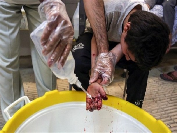 تعداد مصدومان چهارشنبه سوری در کرمانشاه به ۱۲۶ نفر رسید