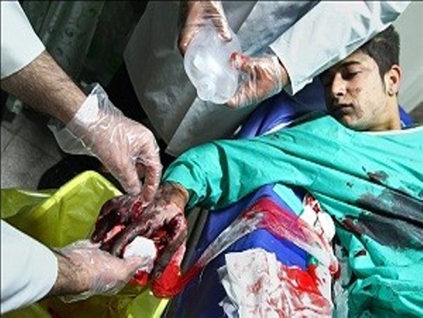 نقص عضو دو شهروند دماوندی در چهارشنبه آخر سال
