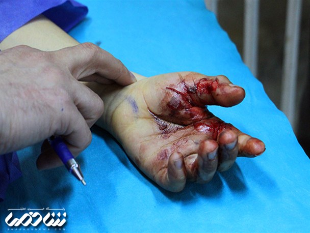 حوادث چهارشنبه آخر سال سمنان، 28 مصدوم به جا گذاشت