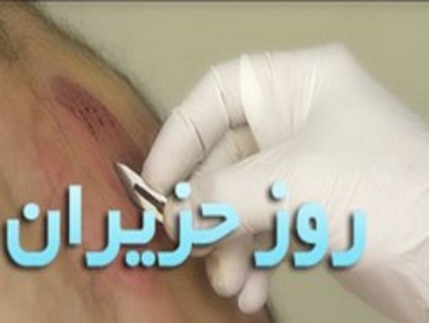 در رابطه با حجامت بیشتر بدانید!