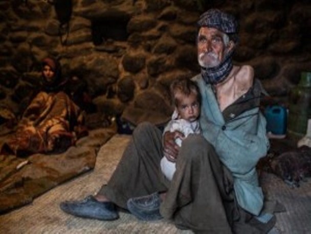 چشم منتظر پیرمرد بی دست در انتظار دستان پر مهر خیران/عکس