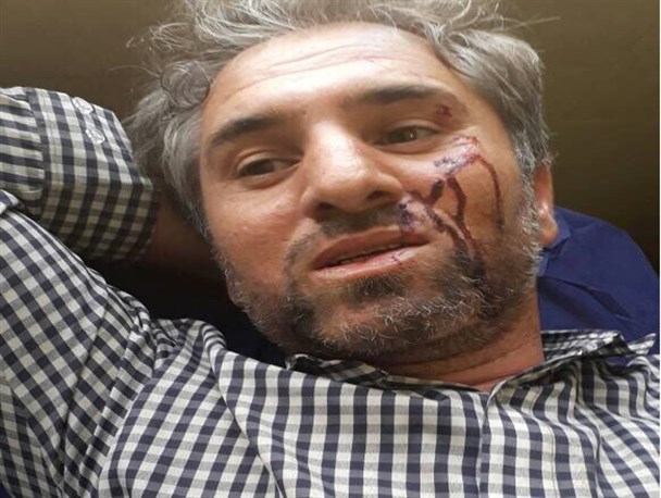 ضرب و شتم رئیس ستاد اصلاح طلبان رئیسی توسط برادر استاندار بوشهر+ عکس