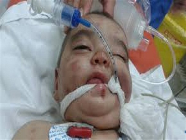 یسنا قربانی دیگر/ کودک دوساله حاجی آبادی به دست پدرش مثله شد