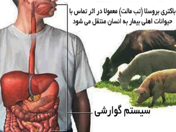 تب مالت، بیماری‌ مشترک انسان و دام/ شیر خام عامل انتقال بیماری به بدن انسان