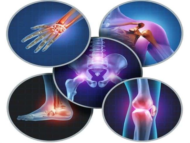 ۷۰ درصد خانم ها در معرض خطر پوکی استخوان و شکستگی هستند