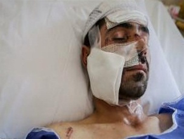 ۱۹ تیم پزشکی در مناطق زلزله زده به ارائه خدمت پرداختند