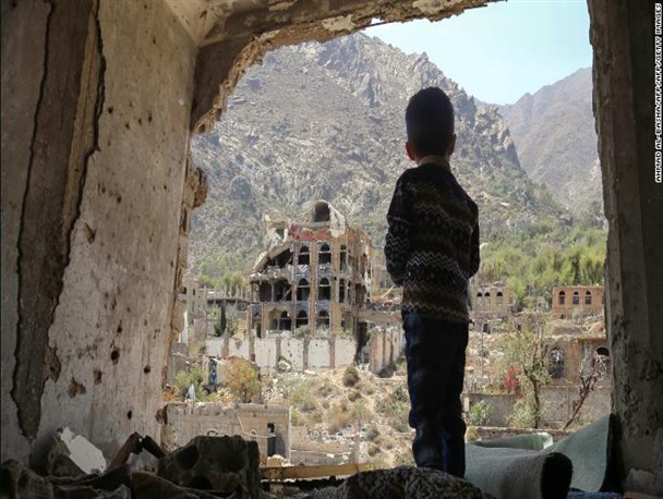 85000 کودک زیر 5 سال در جنگ یمن از گرسنگی جان باخته اند