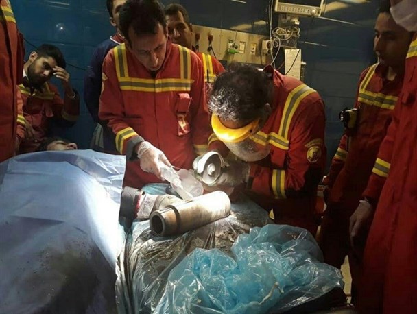 دستگاه آبمیوه‌گیری انگشتان دست دختر ۱۲ساله دهدشتی را بلعید